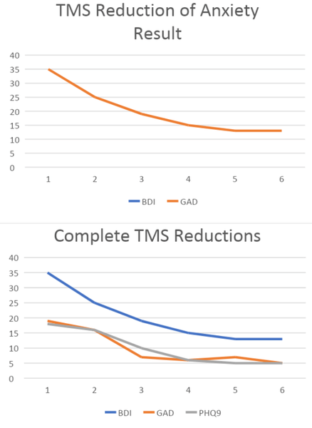 Before and After TMS Therapy