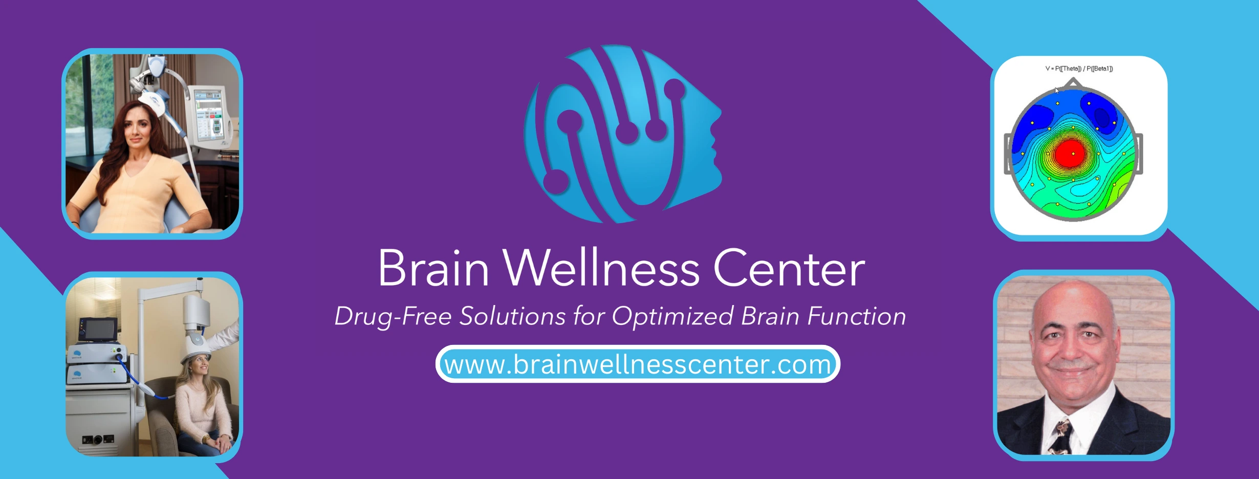 Brain Wellness Center - San Ramon, CA Clinic
