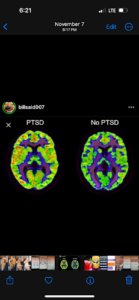 restorative-brain-center-tms-clinic-photo.png